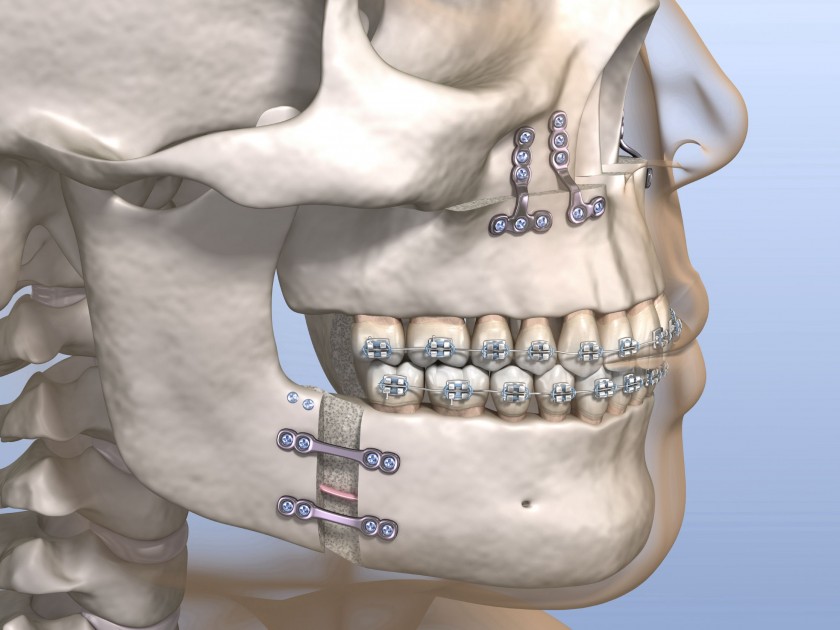 Orthognathics 6